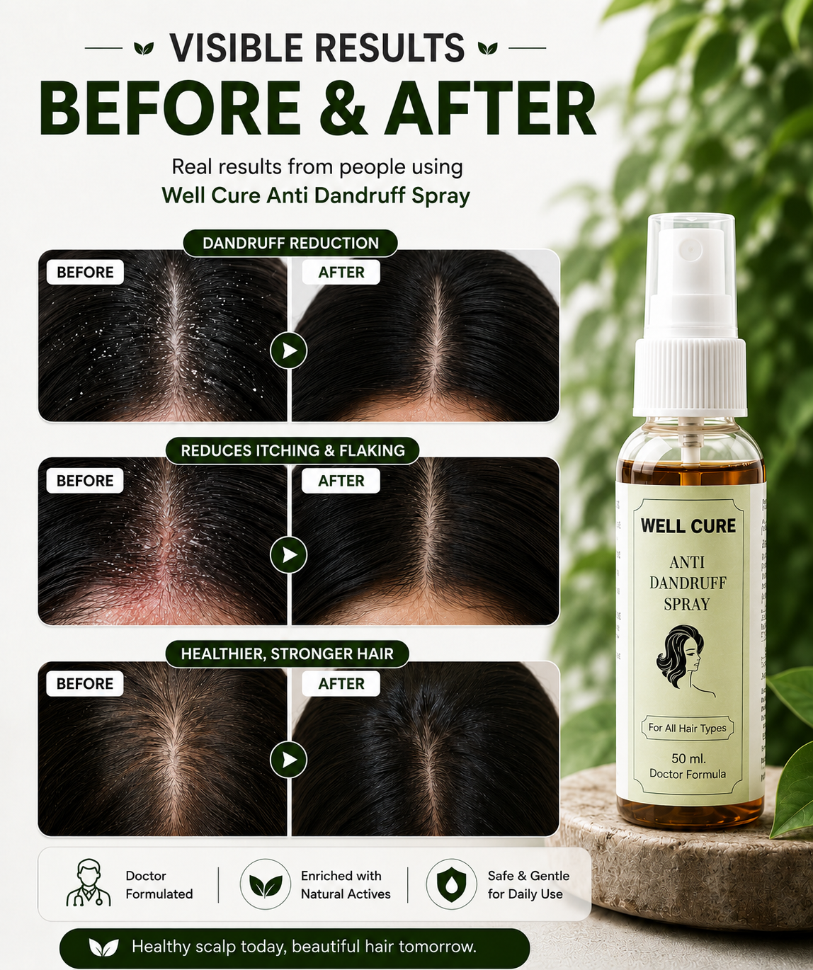 Well Cure Anti Dandruff Spray 50 ML