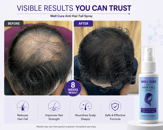 Well Cure Anti Hair Fall Spray