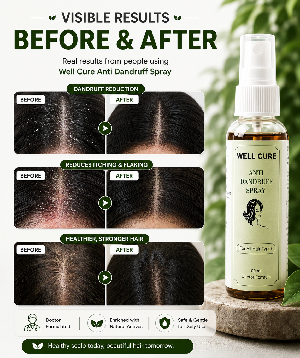 Well Cure Anti Dandruff Spray