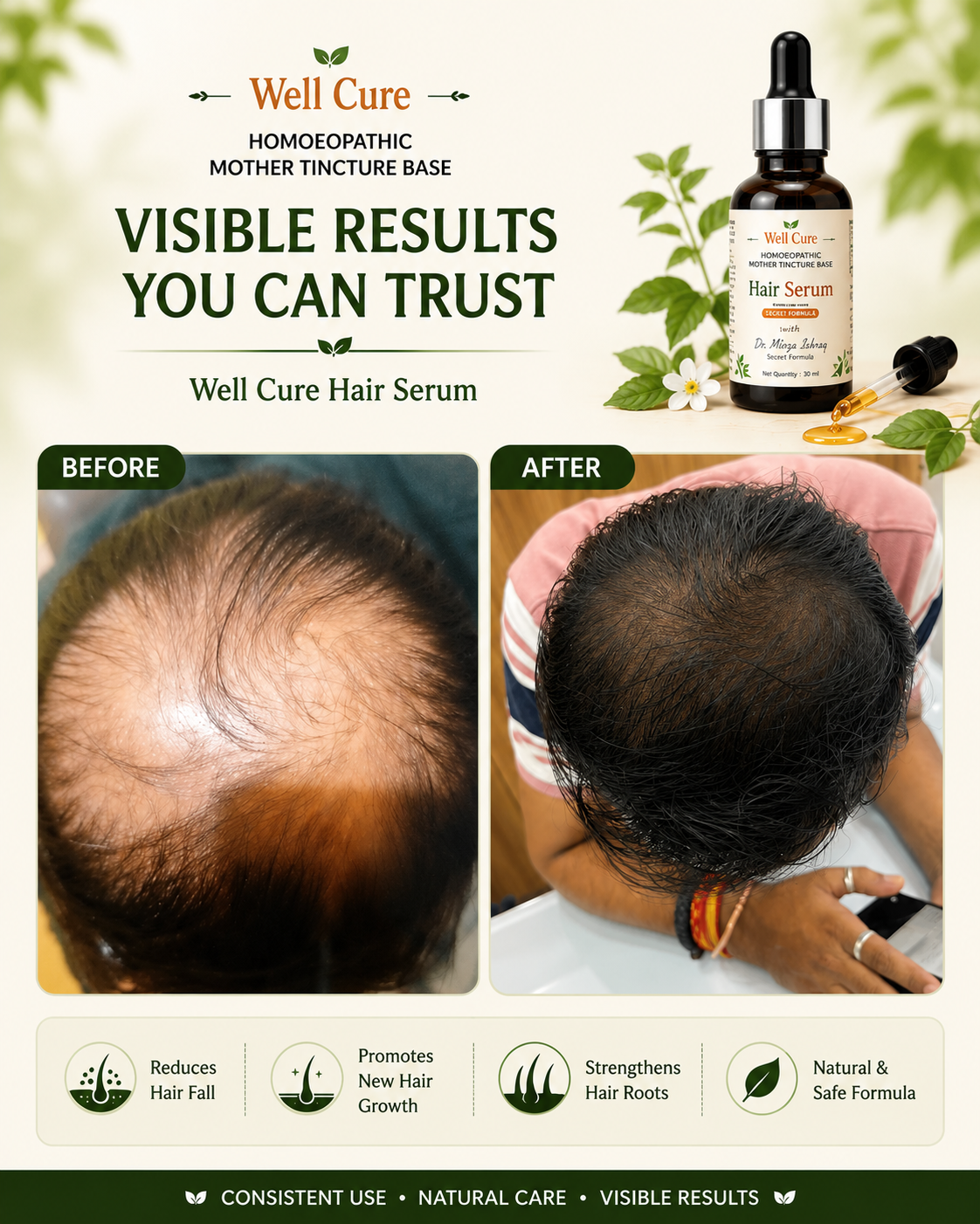 Well Cure Hair Serum – Homoeopathic Mother Tincture Base